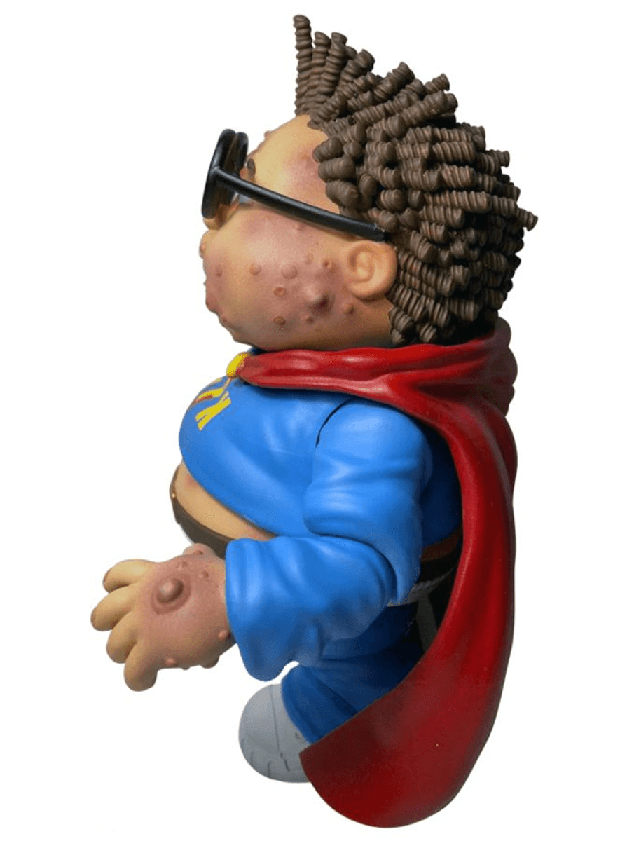 DNAPDNAGPKCW1NATN Garbage Pail Kids - Nat Nerd Action Figure - Premium DNA Toys - Titan Pop Culture